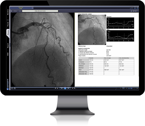 cardiologia